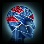 Hiring a Rhode Island Traumatic Brain Injury Lawyer | Slepkow Law